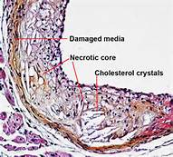 消化系统疾病模子