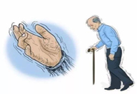 帕金森病，，，“帕”不怕？？？