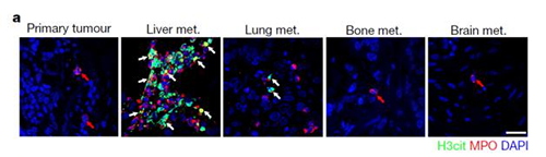 转入小鼠模子获得相同的试验效果，且在转移爆发前NET已在肝脏聚积。。。