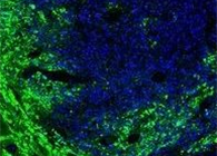 联协实力！溶瘤病毒与CAR-T翻开攻克实体瘤难题的新思绪