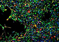 天下首创：：药物将干细胞指导至受损部位，，，提高其愈合能力！