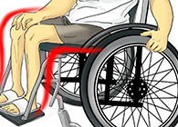 Nature：：：还瘫痪患者一个自由身的日子不远了