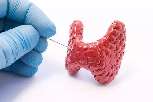 甲状腺疾病，，包括甲状腺功效减退和甲状腺功效亢进，，自古以来就是重复被医学研究职员研究的疾病